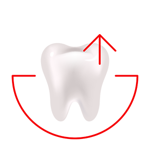 Зміцнення зубів