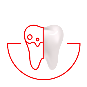 Контроль зубного каменю